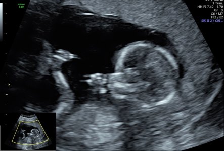 Baby Brown.JPG
