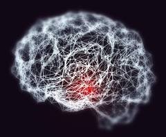 When Will There Be a Cure for Creutzfeldt-Jakob Disease ... When Will There Be a Cure for Creutzfeldt-Jakob Disease ...